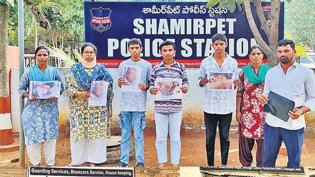 International School | స్కూల్‌ విద్యార్థులపై విచక్షణారహితంగా దాడి.. పోలీసులను ఆశ్రయించిన తల్లిదండ్రులు