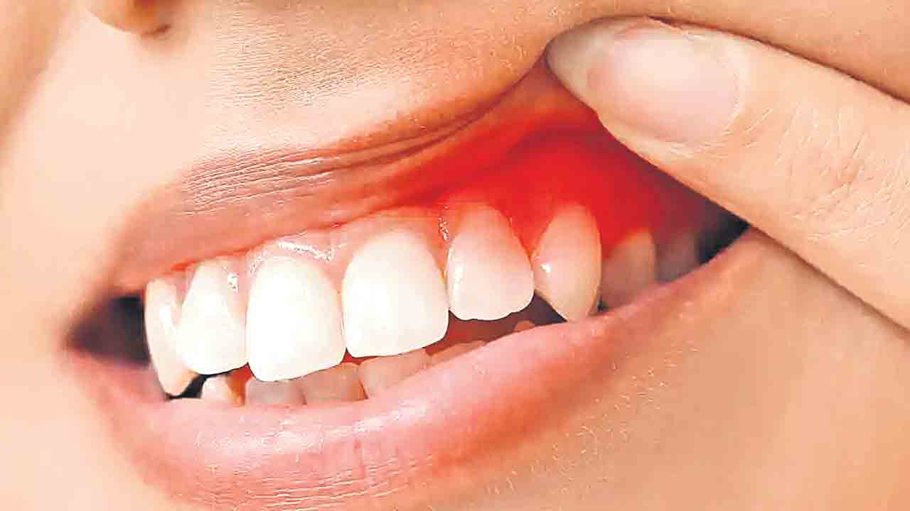 Sugar Attack, Teeth 2
