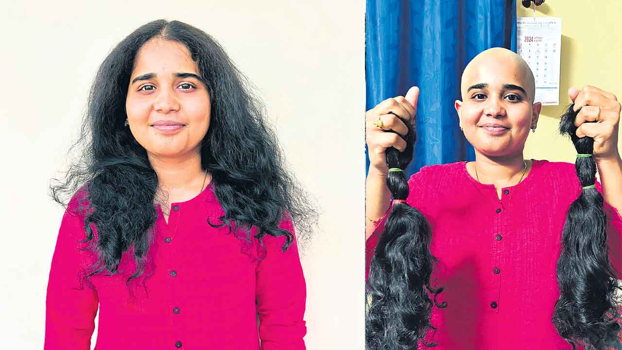 గుండెలు గెలుస్తున్న.. బాల్డ్‌ బ్యూటీస్