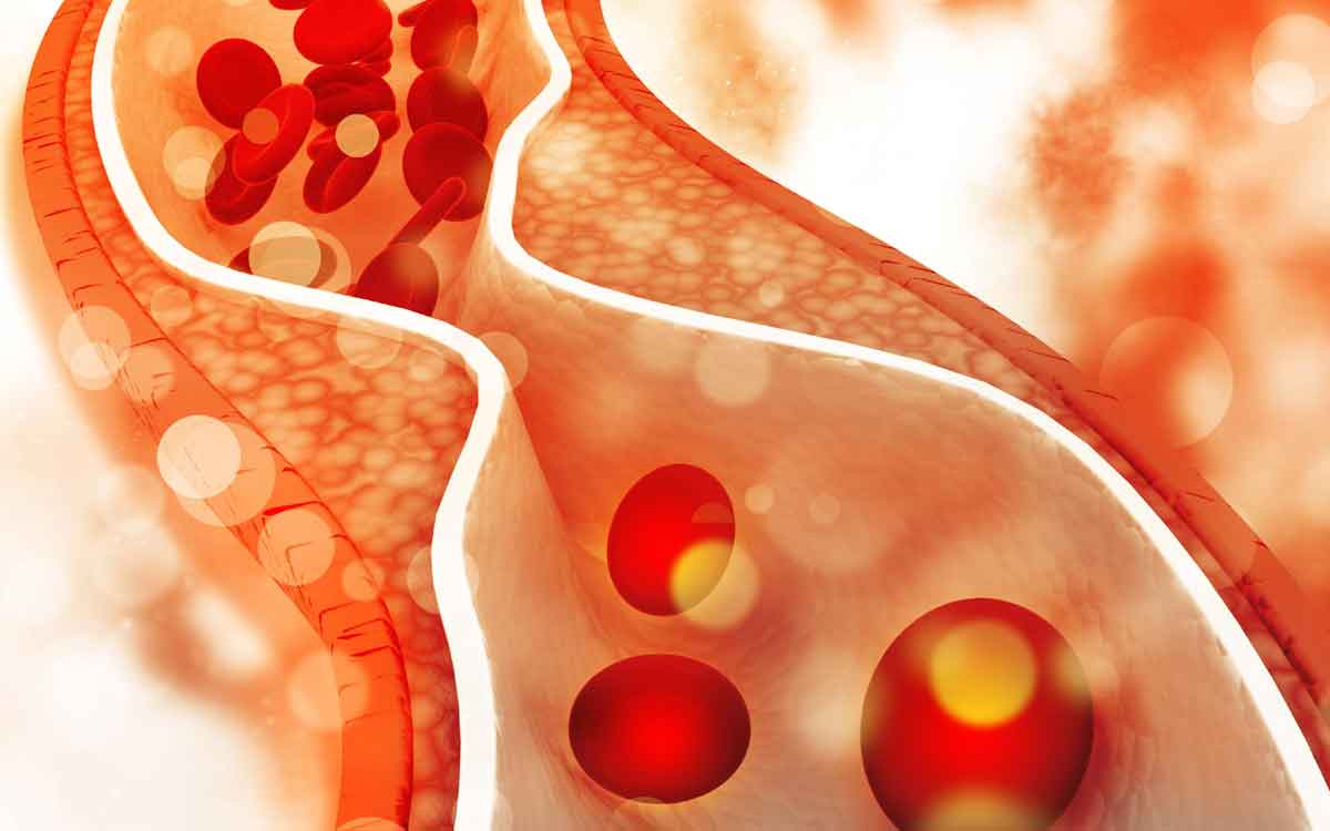 Cholesterol | వీటిని రోజూ తీసుకుంటే చాలు.. కొలెస్ట్రాల్ ఎంత ఉన్నా స‌రే క‌రిగిపోతుంది..!