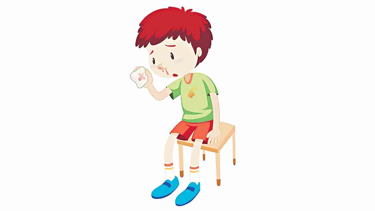 ముక్కులో రక్తస్రావం