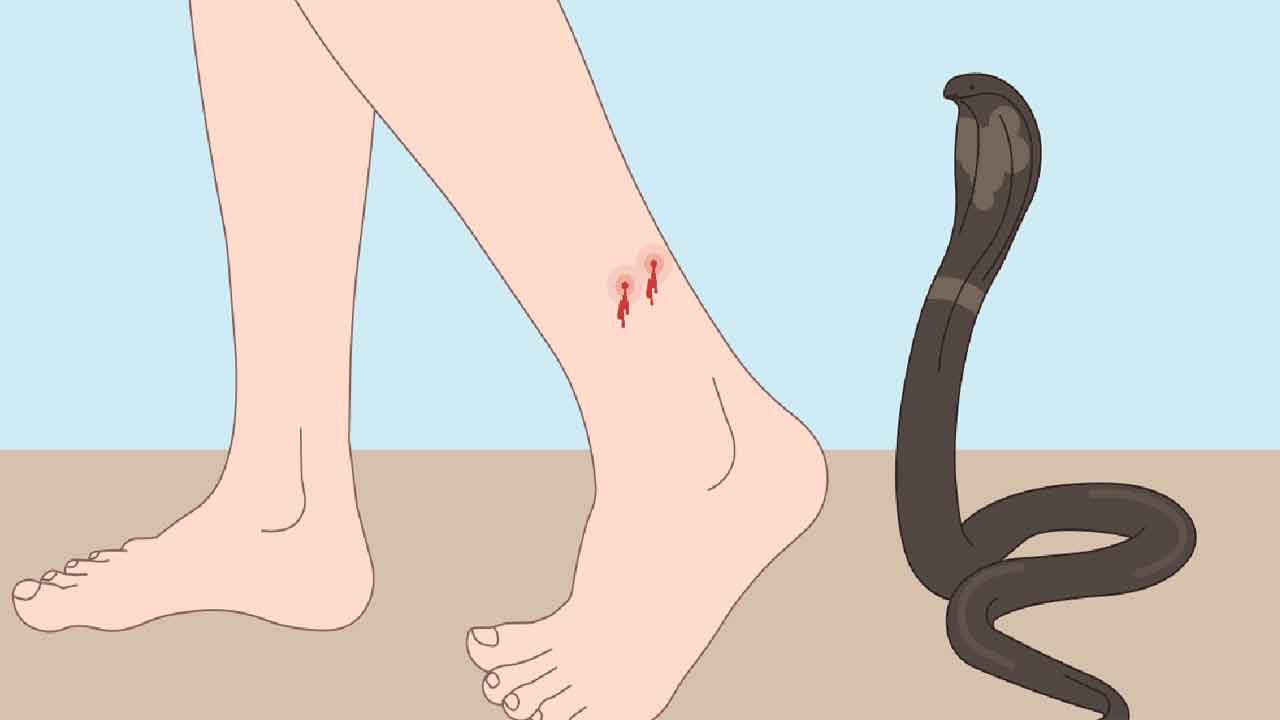 Snakebite Pill | పాముకాటుకు గోలీ.. ట్రయల్స్‌లో సానుకూల ఫలితాలు!