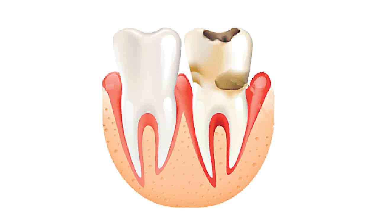 Teeth Problem