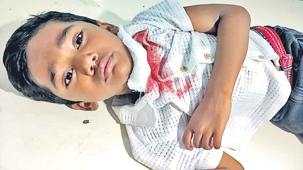 చైనా మాంజా తగిలి నలుగురికి గాయాలు