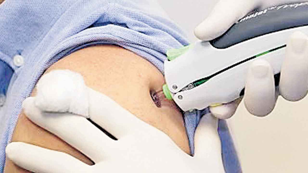 Shock Syringe | సూది లేకుండా, నొప్పి తెలియకుండా.. పెయిన్‌లెస్‌ ఇంజెక్షన్లు