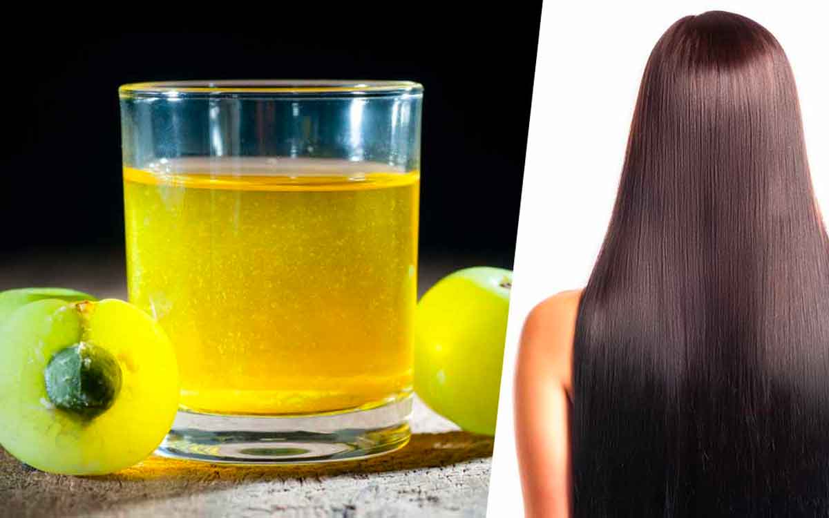 Amla For Hair Growth | చ‌లికాలంలో మీ జుట్టు రాలుతూ అంద విహీనంగా మారిందా..? అయితే ఈ చిట్కాల‌ను పాటించండి..!