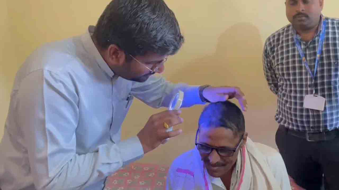 Hair Loss | వారంలోనే వెంట్రుకలన్నీ ఊడిపోతున్నయ్‌.. ఆ మూడు గ్రామాల ప్రజల్లో కలవరపాటు