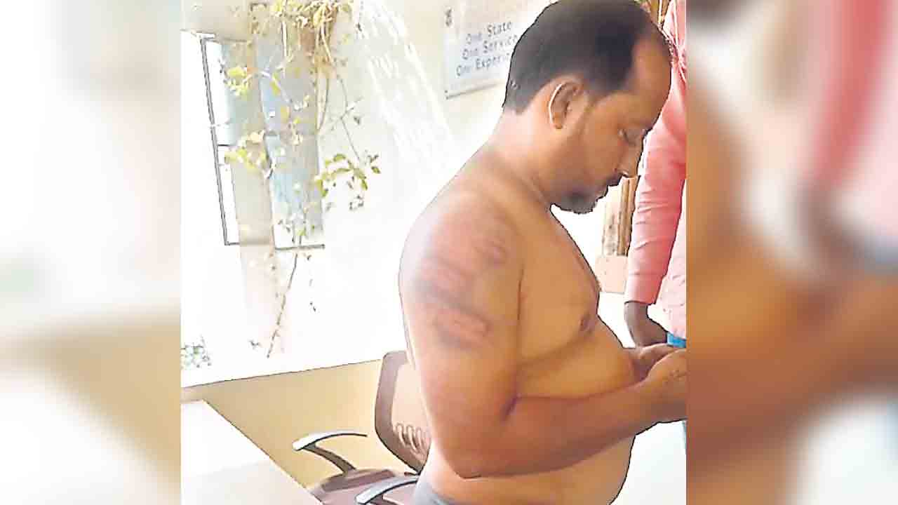 దళిత యువకుడిపై పోలీసు దాష్టీకం