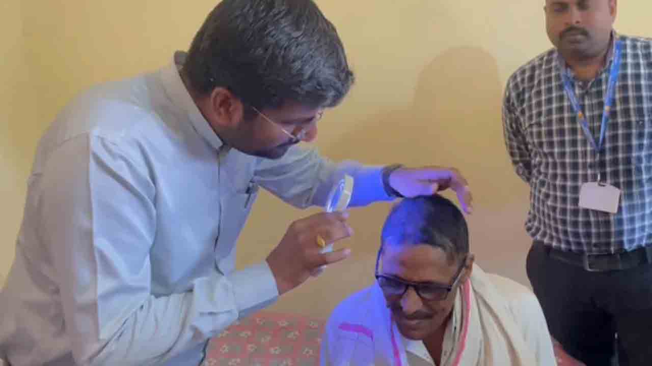 Mass Hair Loss | వేగంగా జుట్టురాలి వారంలో బట్టతల.. మూడు గ్రామాల ప్రజల్లో ఆందోళన