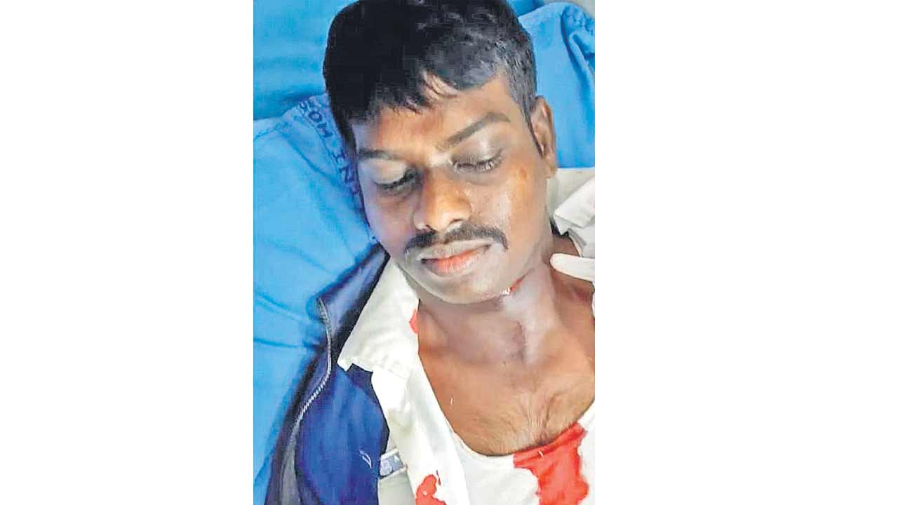 China Manja | మృత్యు పంజా చైనా మాంజా.. మనుషుల గొంతు కోస్తున్న సీసం పూత దారాలు