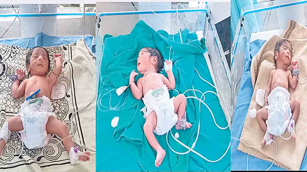 ఒకే కాన్పులో ముగ్గురు జననం