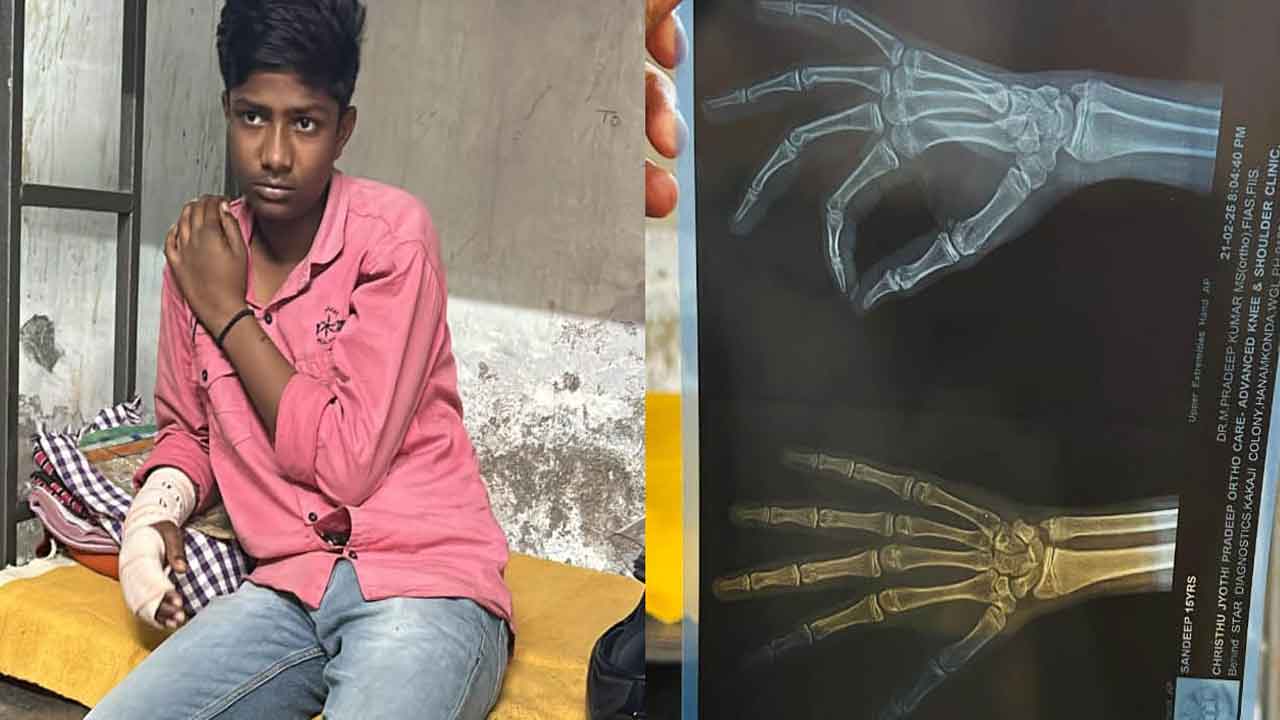 విద్యార్థులను చితకబాదిన వార్డెన్‌