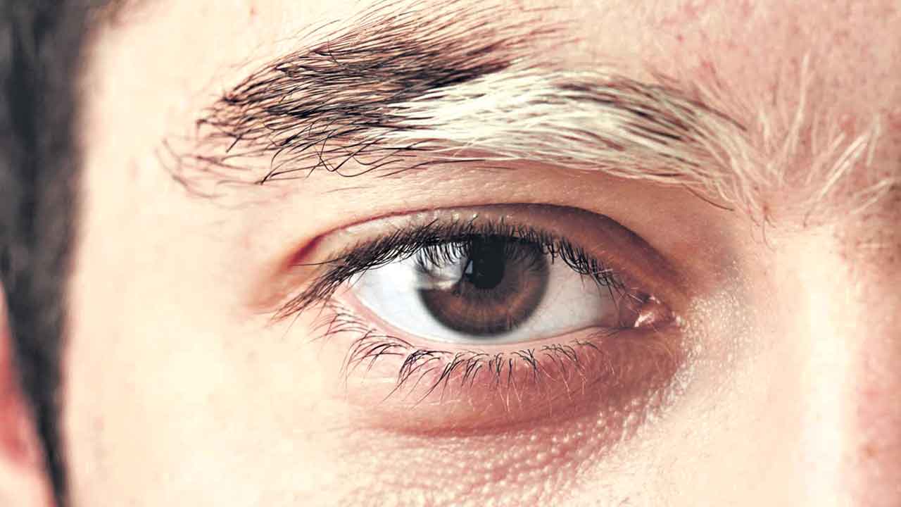 ‘తెల్ల’ బోవొద్దంటే..