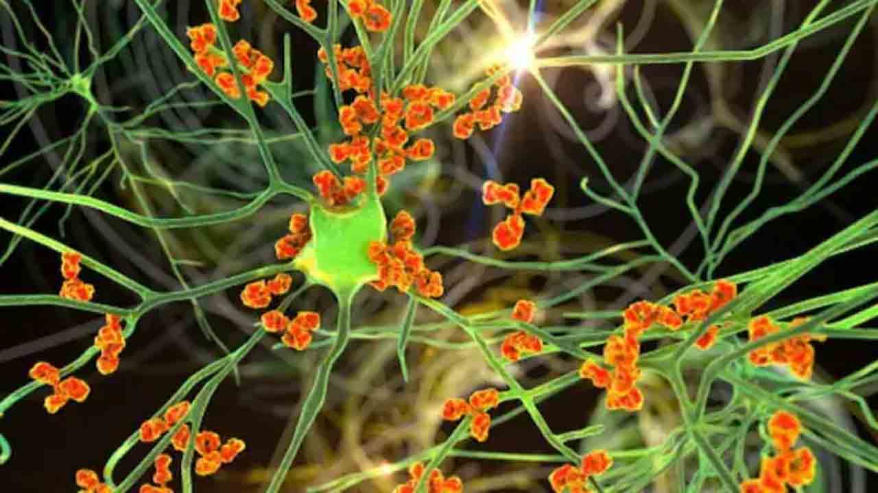 Guillain Barre Syndrome | మహారాష్ట్రలో 172కు పెరిగిన జీబీఎస్‌ కేసులు.. ముంబైలో తొలి మరణం