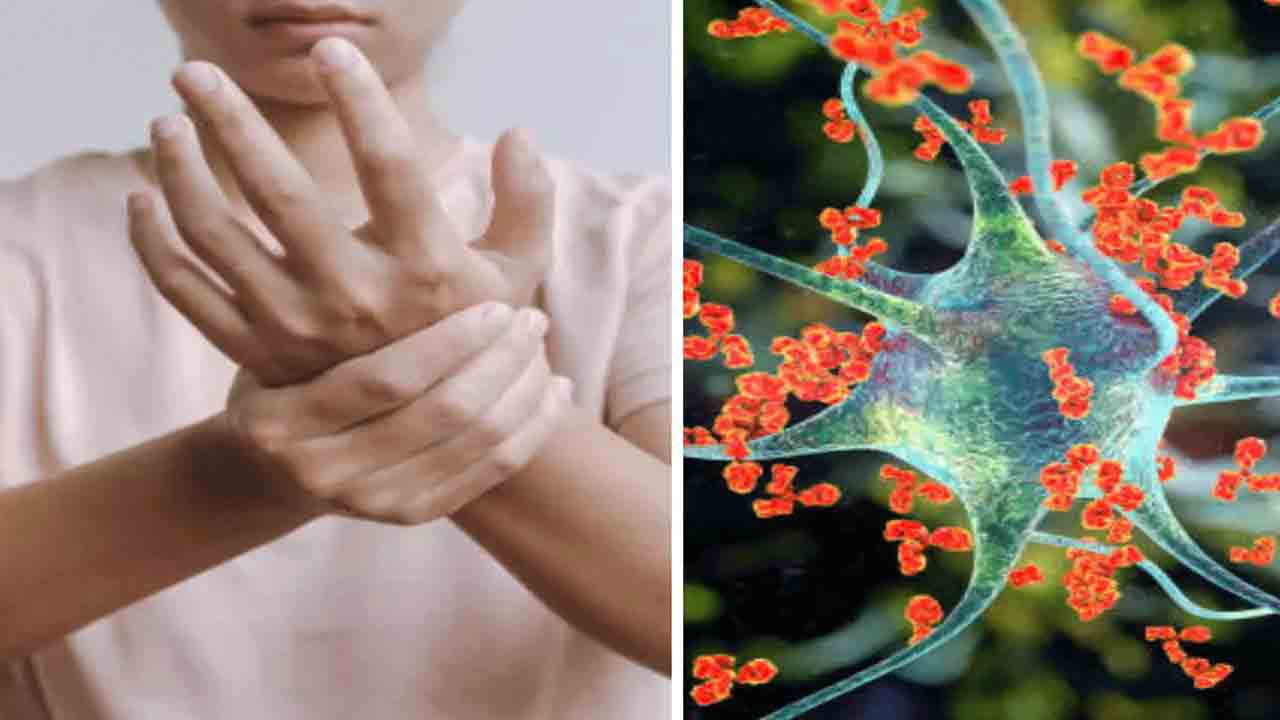 GBS Death | రాష్ట్రంలో తొలి జీబీఎస్‌ మరణం.. చికిత్స పొందుతూ 25 ఏండ్ల మహిళ మృతి