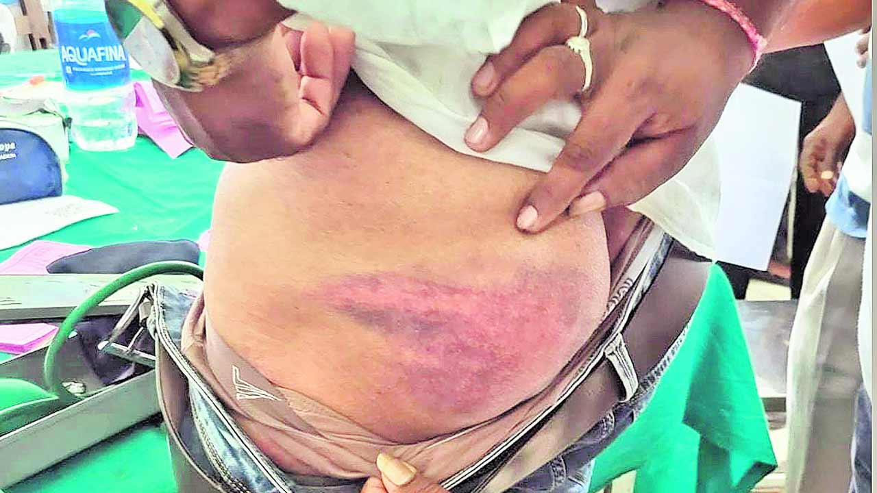 ఇదేనా ఫ్రెండ్లీ పోలీస్‌