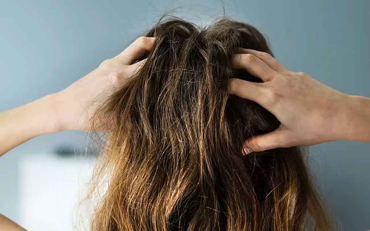 Itchy Scalp | మీ జుట్టు మొత్తం దుర‌ద‌గా ఉంటుందా..? అయితే ఈ చిట్కాల‌ను పాటించండి..!