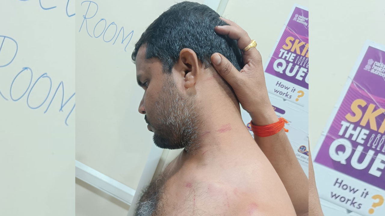 Kollapur | కొల్లాపూర్లో జూపల్లి అనుచరుల వీరంగం.. బీఆర్ఎస్ కార్యకర్తలపై దాడి.. సహించేదిలేదన్నఎమ్మెల్సీ కవిత