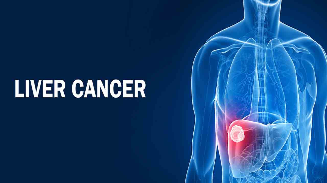 Liver Cancer | కూరగాయలతో కాలేయ క్యాన్సర్‌కు చెక్‌.. 65శాతం వరకు అడ్డుకోవచ్చంటున్న సైంటిస్టులు