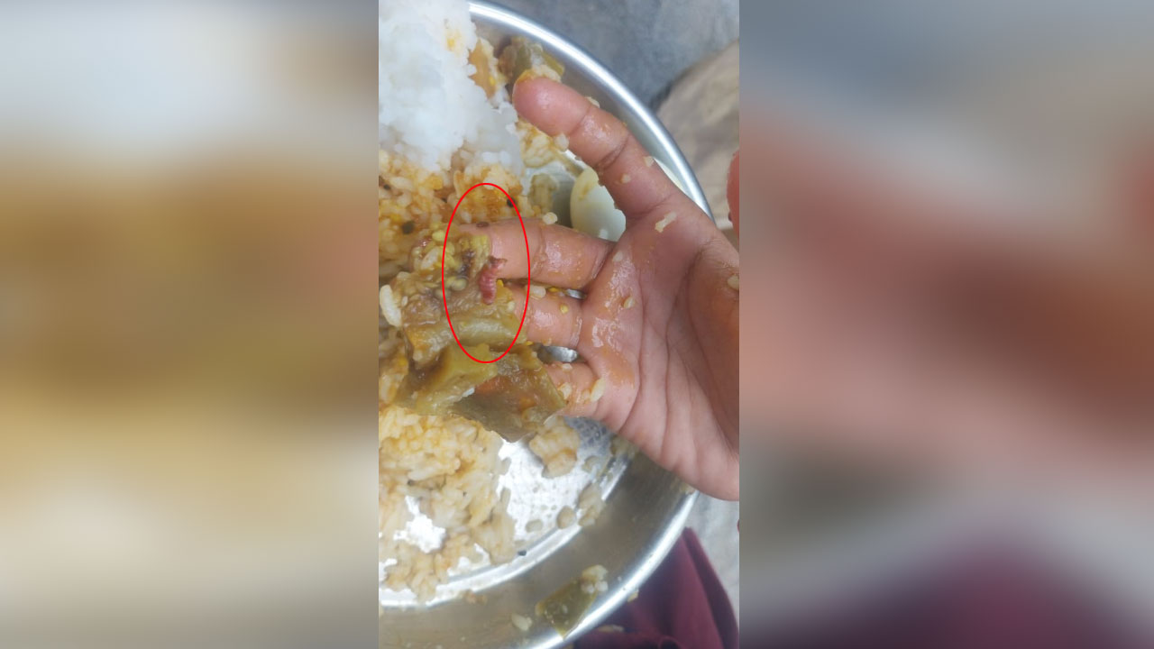 Hyderabad | మధ్యాహ్న భోజనంలో పురుగులు.. వ్యాధులు బారిన ప‌డుతున్న విద్యార్థులు