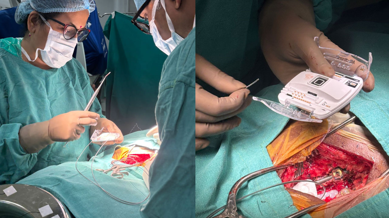 NIMS | వెన్నుపూస విరిగిన వ్యక్తికి కొత్త జీవితాన్నిచ్చిన నిమ్స్ వైద్యులు.. రాష్ట్రంలోనే తొలిసారి ఈ త‌రహా శ‌స్త్ర చికిత్స‌