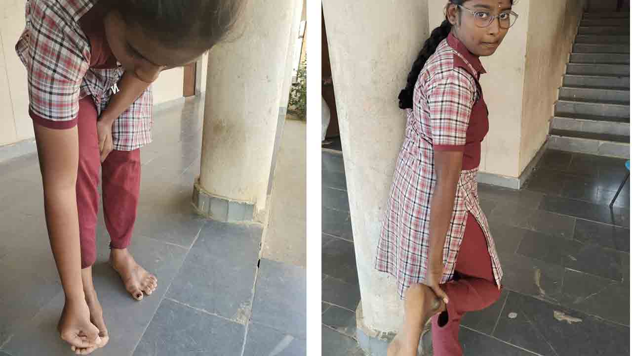 ఎలుకలు కొరికినా బయటకు చెప్పొద్దు