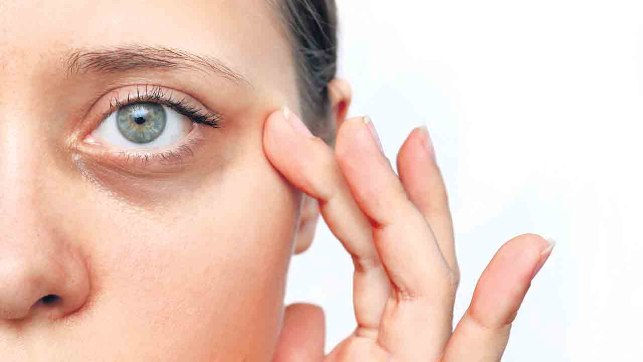 వలయాలను వదిలించుకోండి