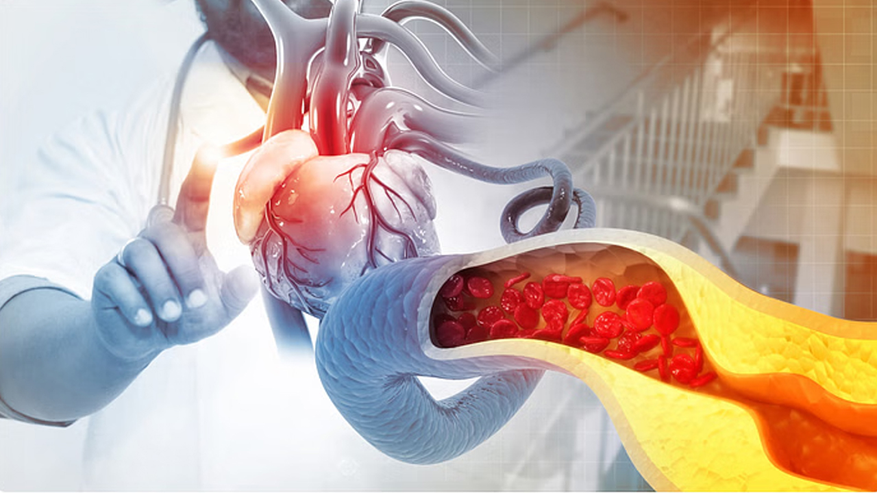 Cholesterol | హై కొలెస్ట్రాల్‌తో ఇబ్బందిపడుతున్నారా..? 80/20 విధానంతో చెక్ పెట్టండి..!