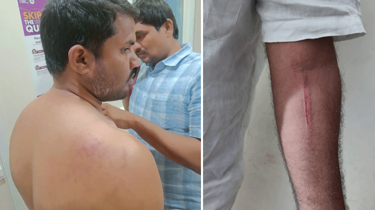 కాంగ్రెస్‌ గూండాయిజం