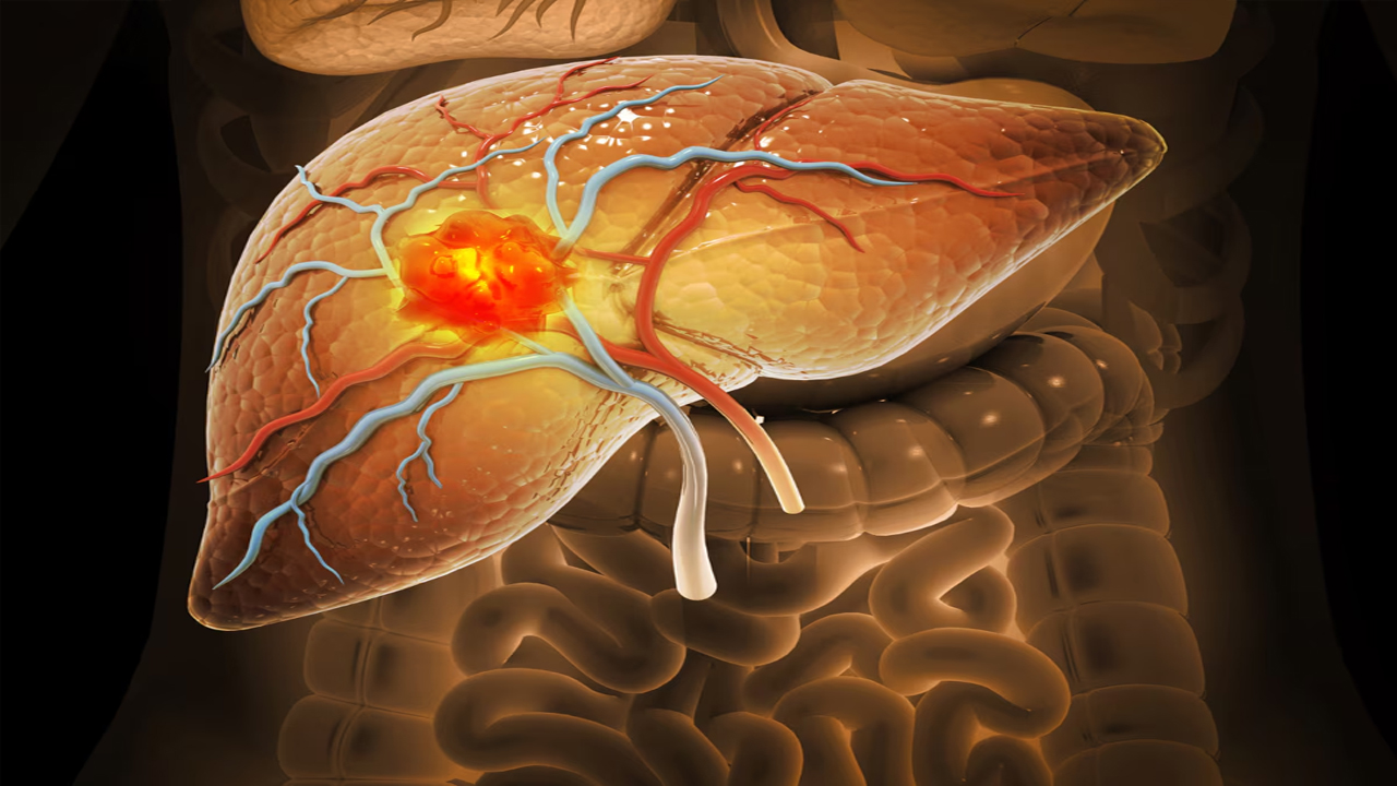 Liver Damage | కాలేయ స‌మ‌స్యలు వేధిస్తున్నాయా..? ఈ ఐదు డ్రింక్స్ ఇవాళ్టి నుంచే తాగడండి..!