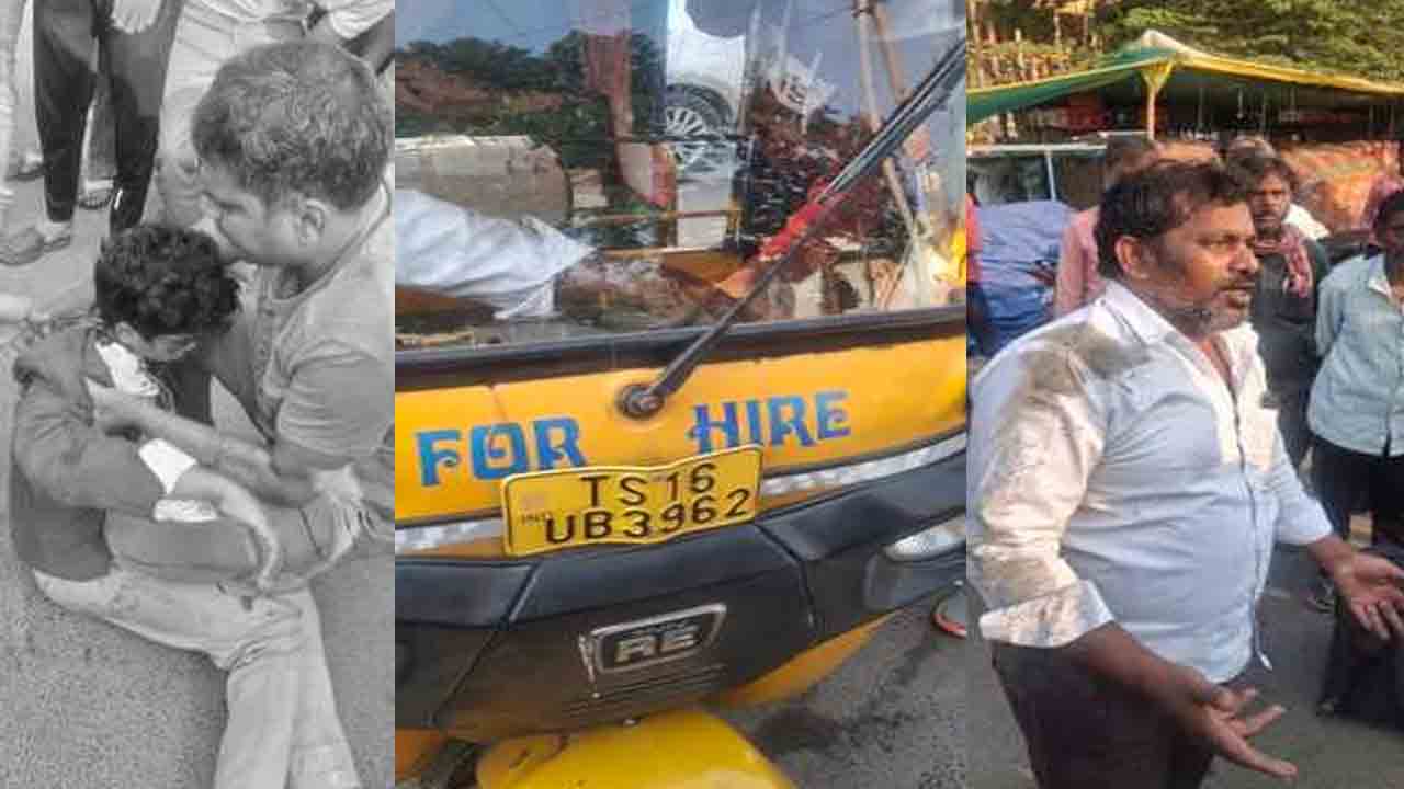 Road Accident | రోడ్డు ప్రమాదంలో విద్యార్థికి తీవ్ర గాయాలు
