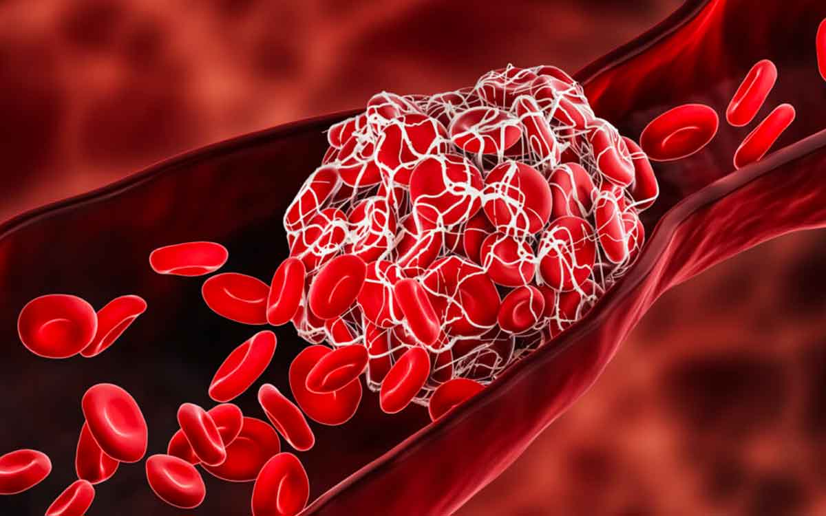 Blood Thinning Foods | ర‌క్తాన్ని ప‌లుచ‌గా చేసే ఆహారాలు ఇవి.. త‌ర‌చూ తీసుకుంటే గుండె పోటు రాదు..!