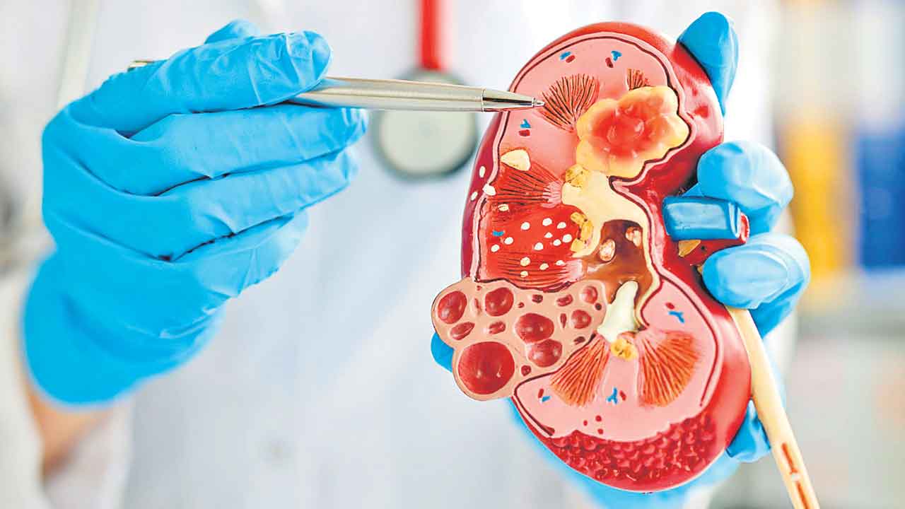 Kidney
