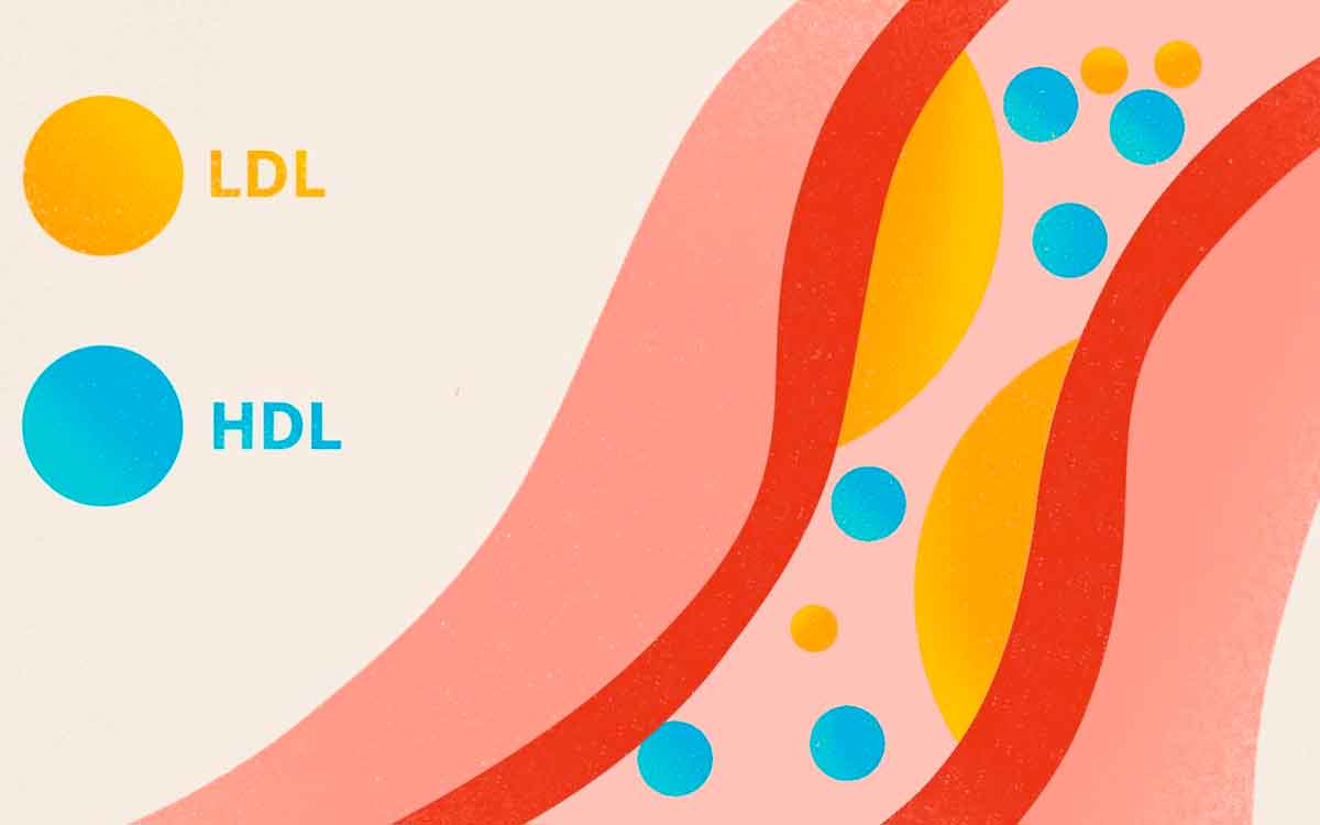 Cholesterol | ఎల్‌డీఎల్‌, హెచ్‌డీఎల్ అంటే ఏమిటి..? కొలెస్ట్రాల్‌ను త‌గ్గించుకోవాలంటే ఏం చేయాలి..?