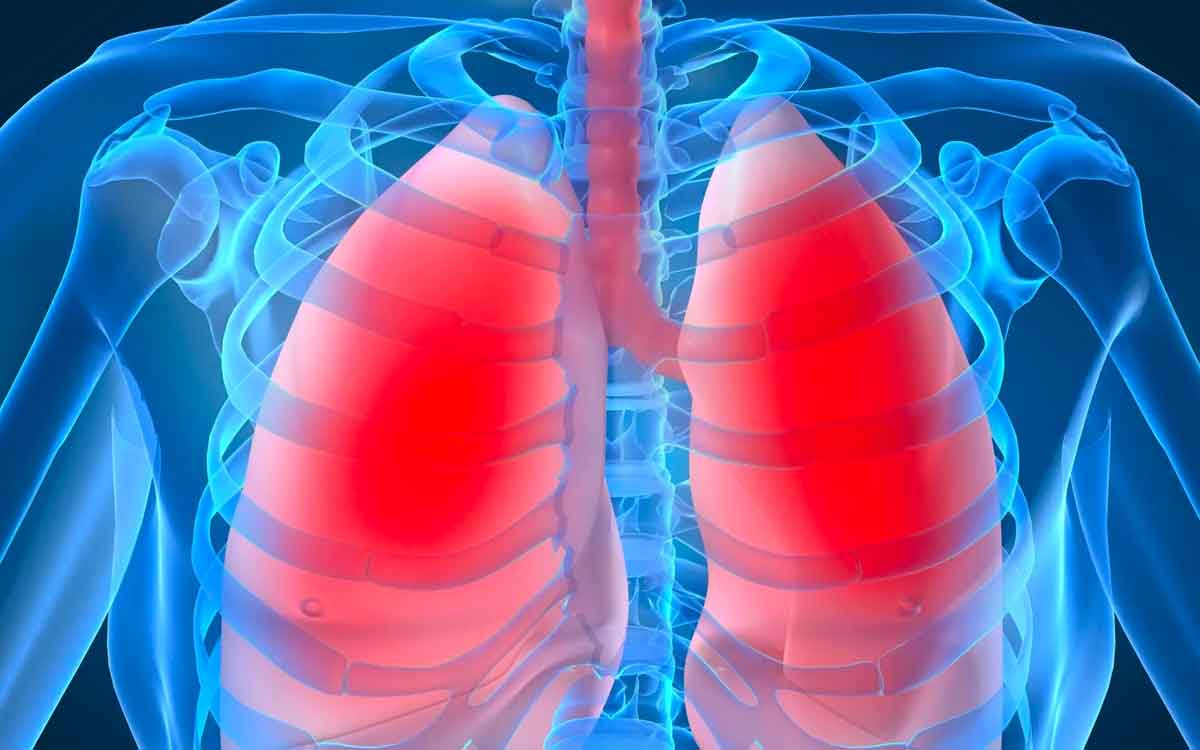 Lungs Cleaning Foods | రోజూ వీటిని తీసుకోండి.. మీ ఊపిరితిత్తులు క్లీన్ అవుతాయి.. లంగ్ క్యాన్స‌ర్ రాదు..