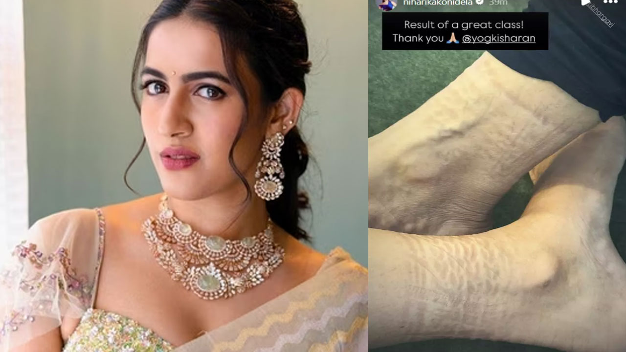 Niharika| నిహారిక పాదాలు ఏంటి ఇలా అయిపోయాయి.. టేక్ కేర్ అంటున్న నెటిజ‌న్స్