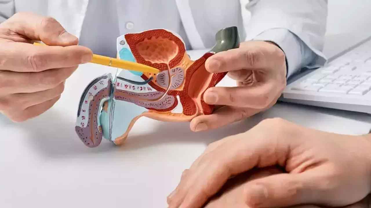 Prostate Cancer | ప్రొస్టేట్‌ క్యాన్సర్‌ స్క్రీనింగ్‌కు గైర్హాజరుతో మరణ ముప్పు!