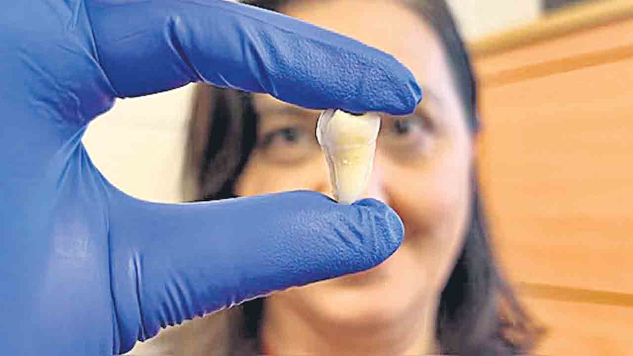Lab-Grown Teeth | ప్రయోగశాలలో మానవ దంతం అభివృద్ధి.. ఇంప్లాంట్స్‌, ఫిల్లింగ్‌కు ఇక చెల్లు!