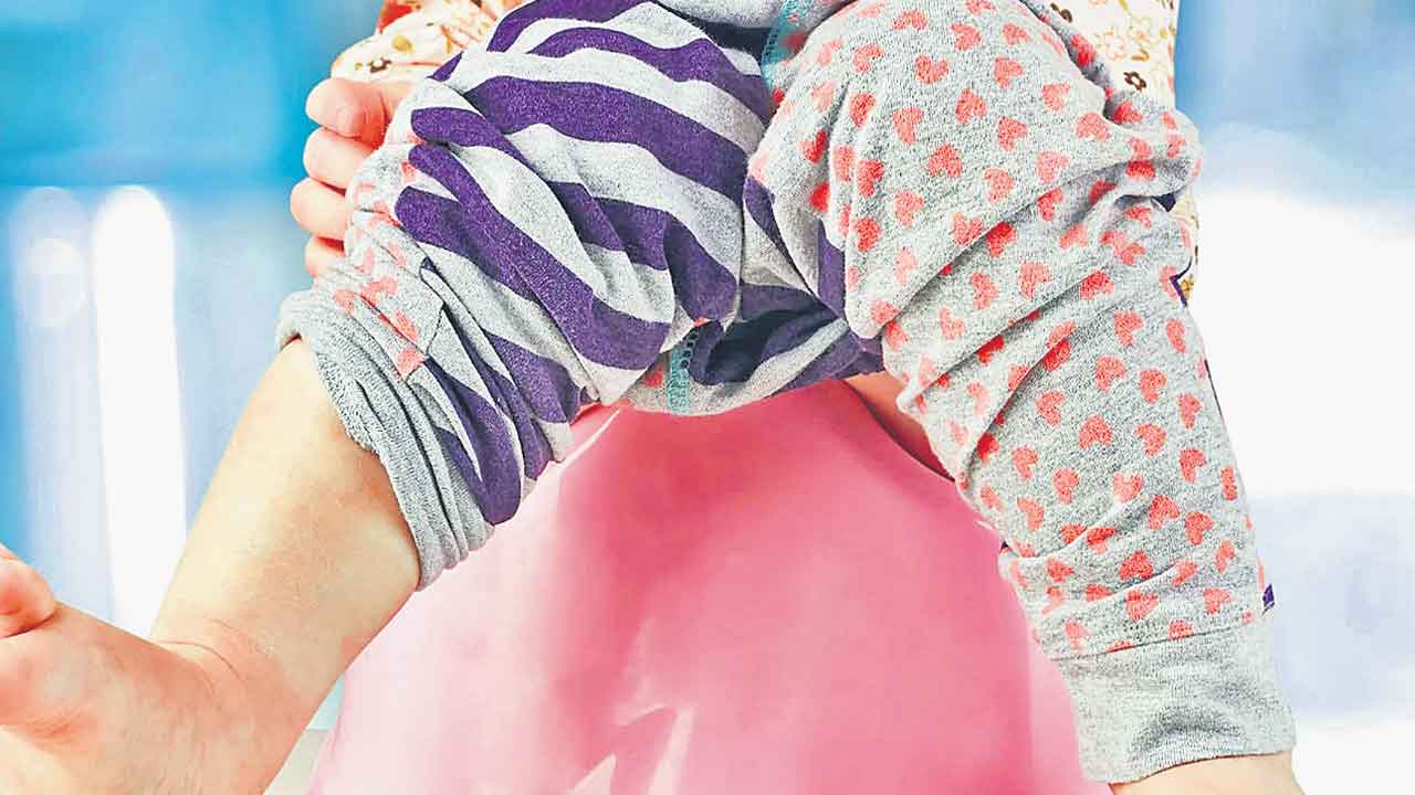 బాబుకు సర్కంసిషన్ అవసరమా?