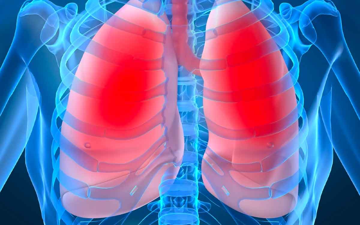 Foods For Lungs Health | మీ ఊపిరితిత్తులు సేఫ్‌గా ఉండాలంటే త‌ర‌చూ ఈ ఆహారాల‌ను  తినండి