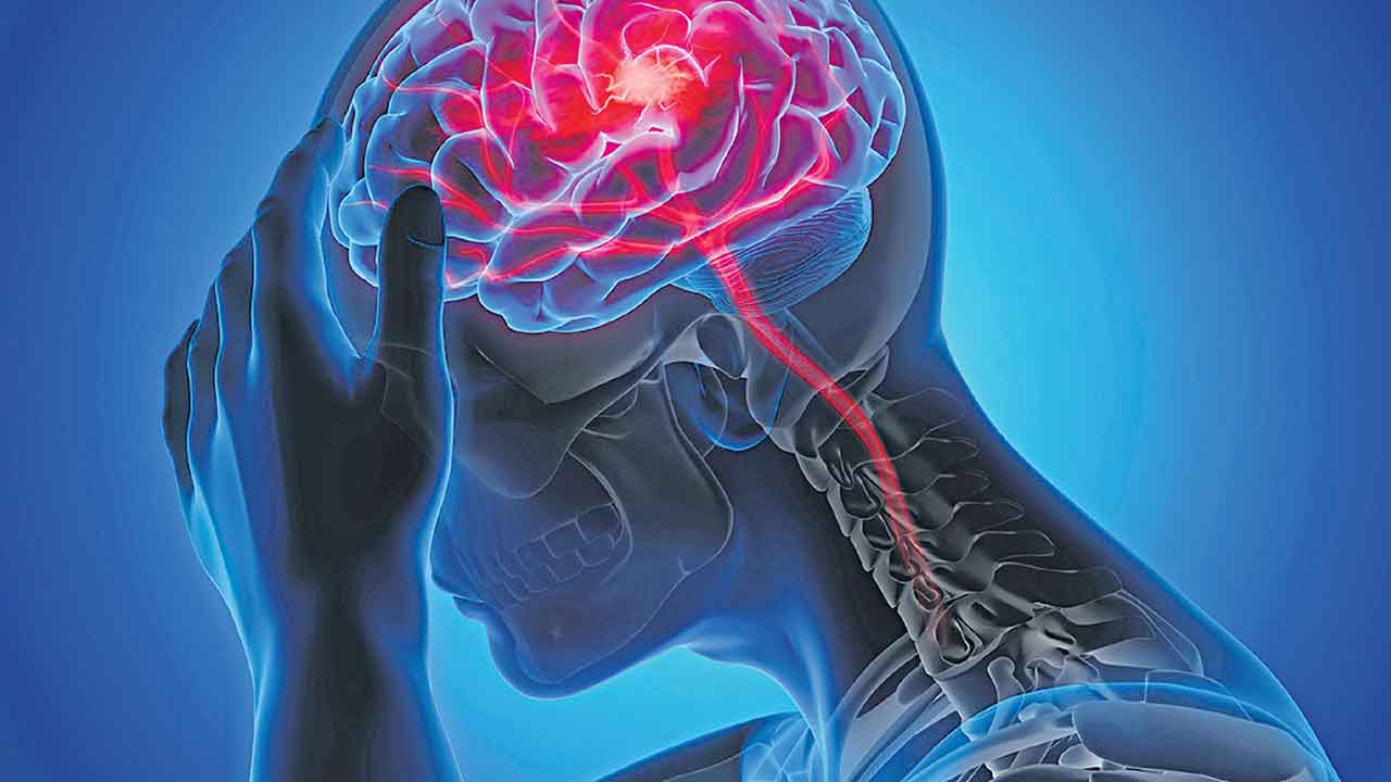 Stroke | థ్రాంబెక్టమీతో స్ట్రోక్‌కు చెక్.. అసలు పక్షవాతం ఎందుకు వస్తుంది?