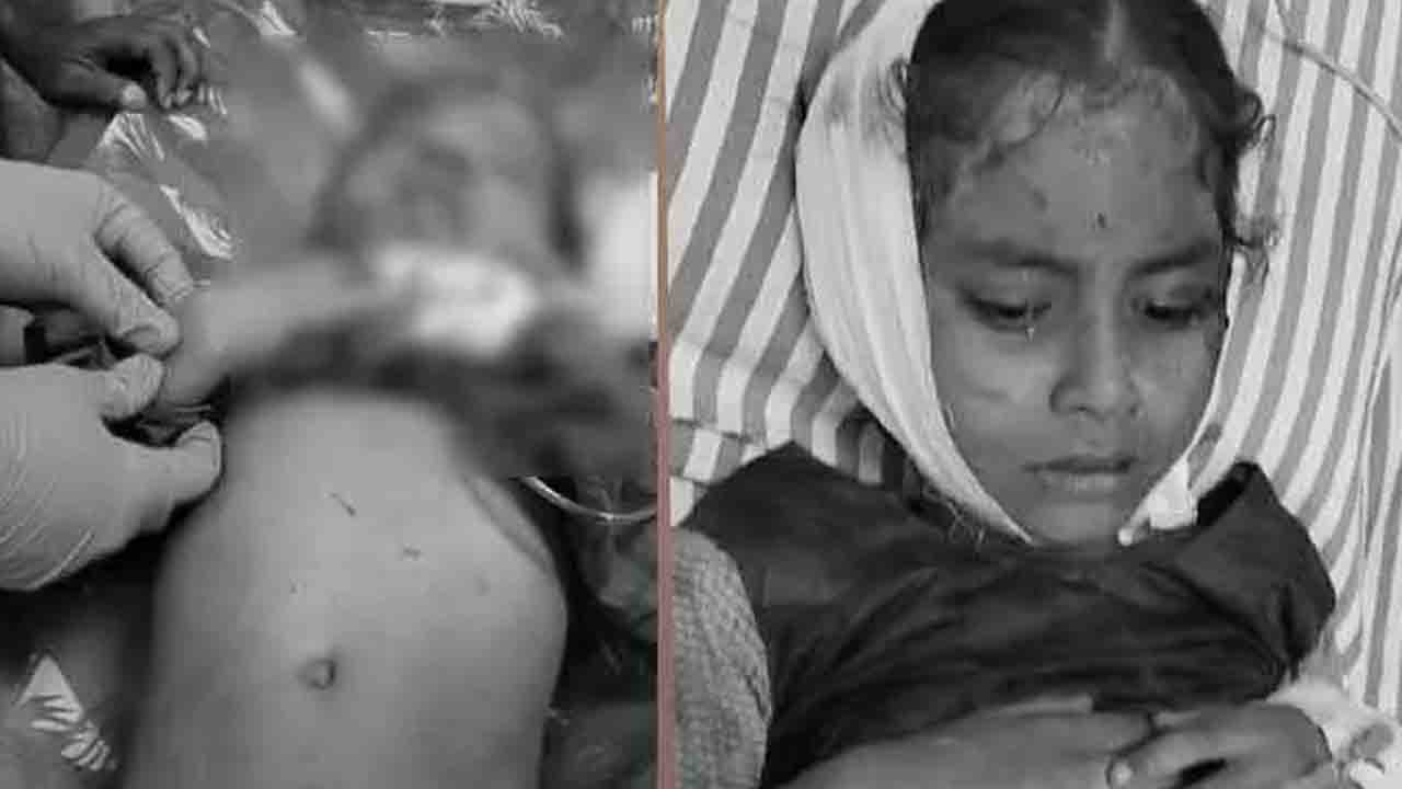 బావిలో పడి ఇద్దరు చిన్నారులకు తీవ్ర గాయాలు