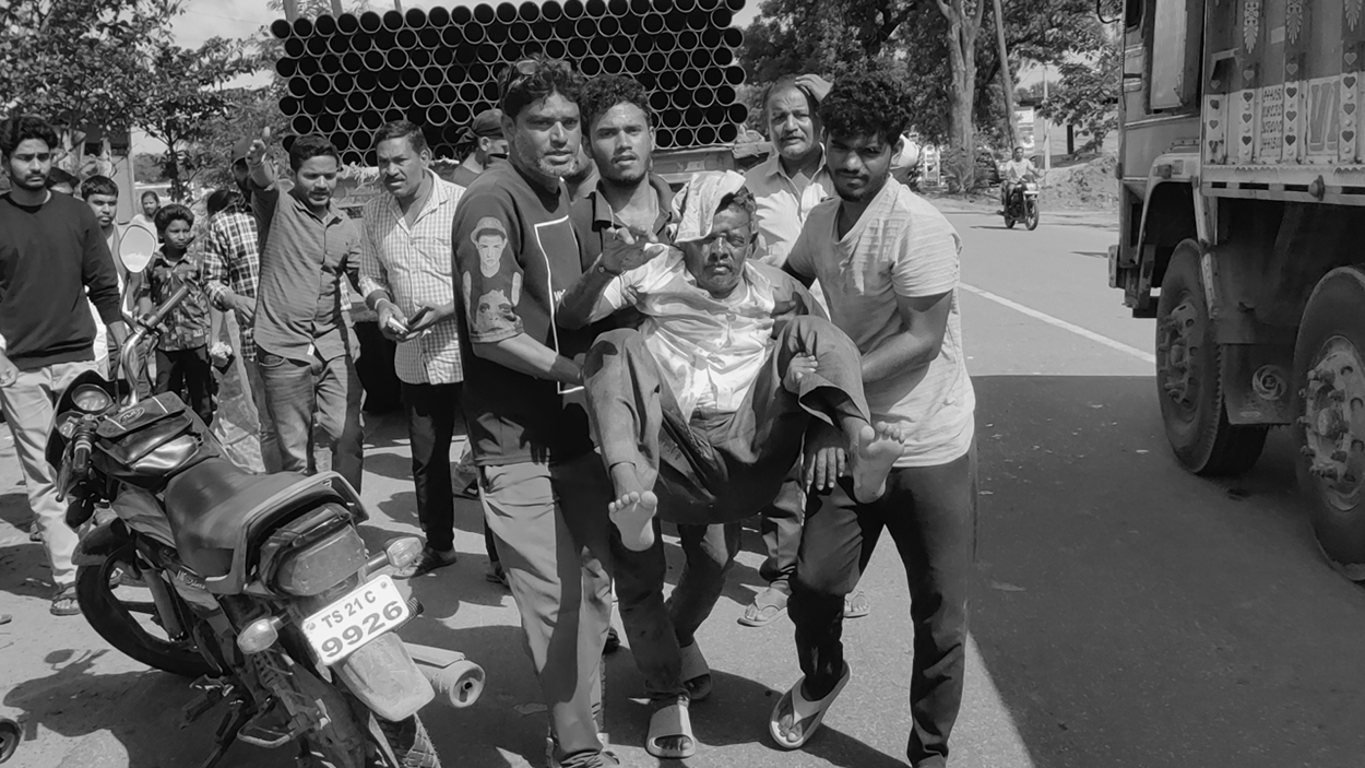 Road Accident | రోడ్డు ప్రమాదంలో ఒకరికి తీవ్ర గాయాలు