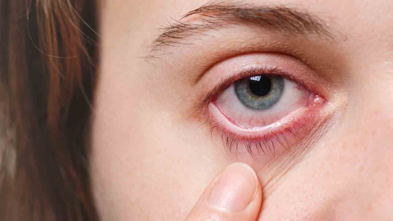 కళ్లు పొడిబారుతుంటే..!