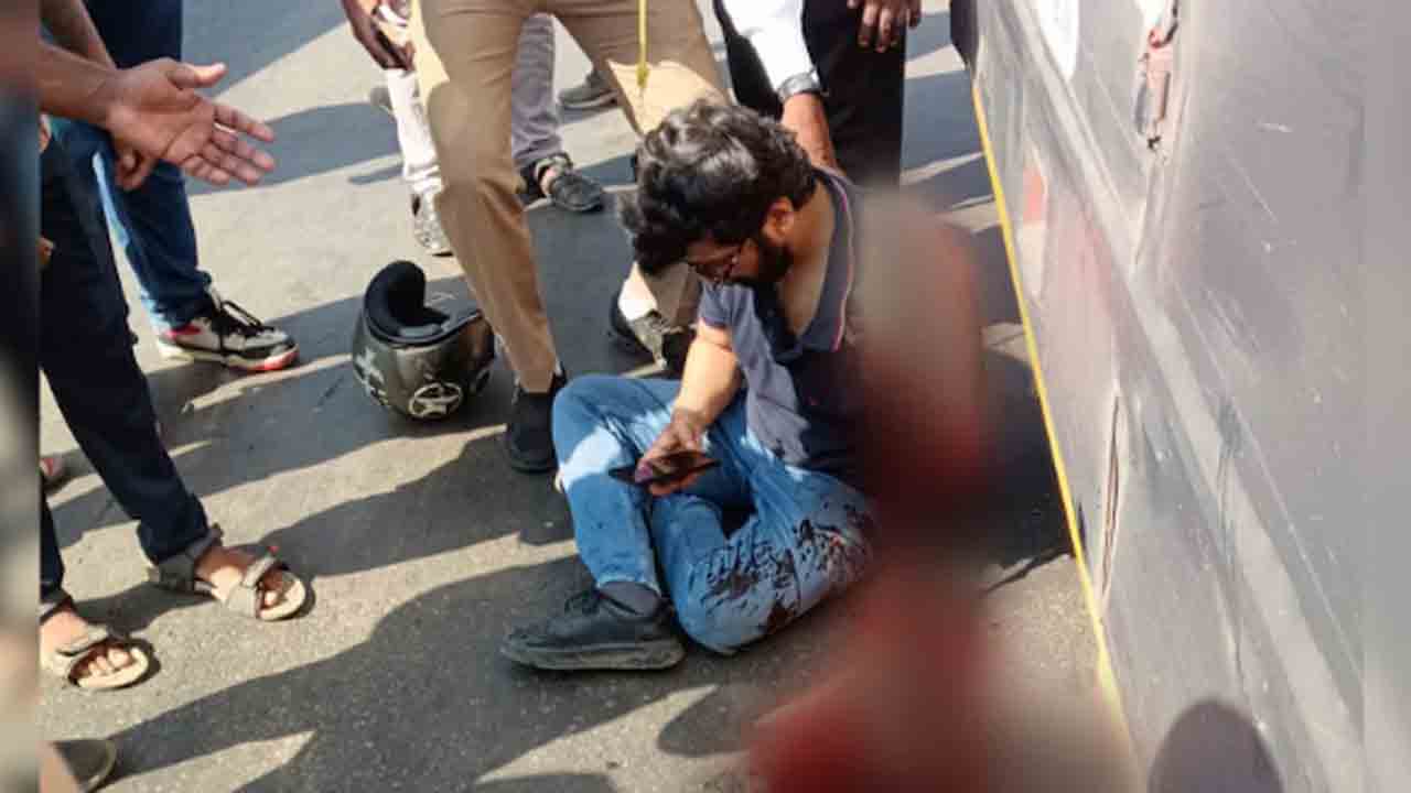 Man’s Hand Severed | బస్సును ఢీకొట్టిన బైక్.. తెగిన వ్యక్తి చేయి