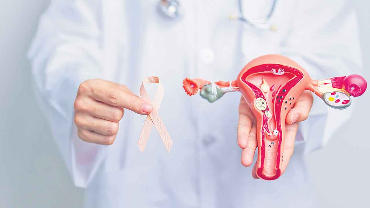 Ovarian Cance 2