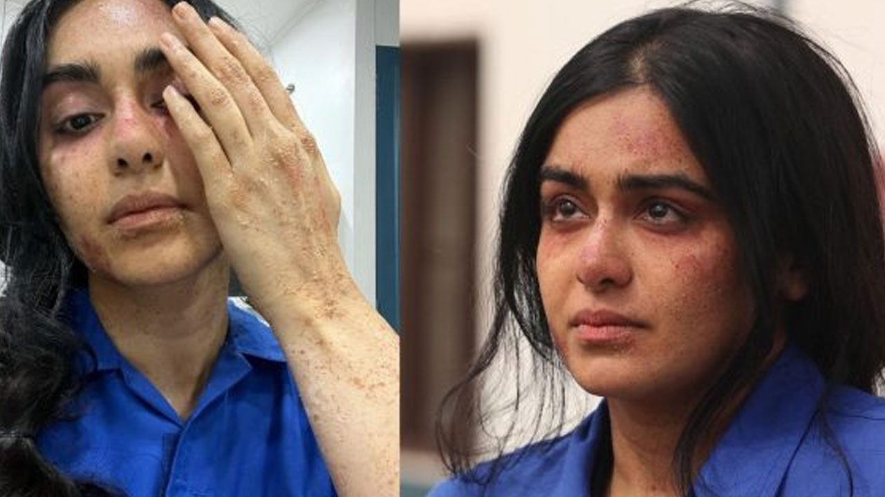 Adah sharma | ఏంటి.. ఈ హీరోయిన్ ఫేస్ ఇలా అయిపోయింది.. కంగుతింటున్న ఫ్యాన్స్