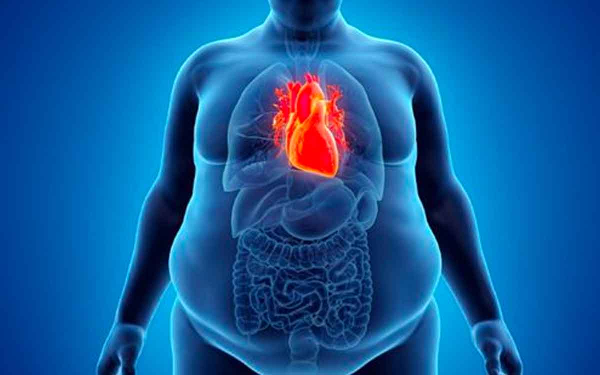 Obesity | స్థూల‌కాయం స‌మ‌స్య‌తో బాధ‌ప‌డుతున్నారా..? అయితే ఈ సింపుల్ చిట్కాల‌ను పాటిస్తే చాలు..!