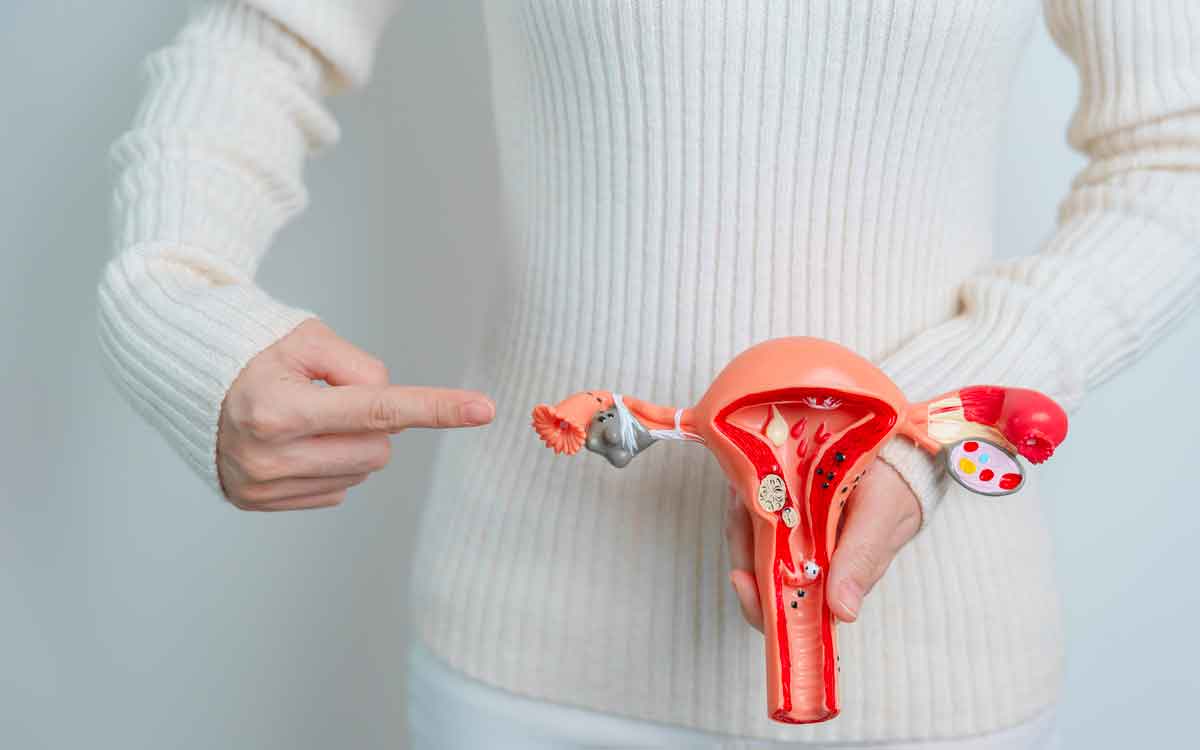 Dietary Tips For PCOS | పీసీవోఎస్ ఉన్న మ‌హిళ‌లు త‌ప్ప‌నిస‌రిగా పాటించాల్సిన డైట్.. క‌చ్చితంగా వీటిని తీసుకోవాలి..!