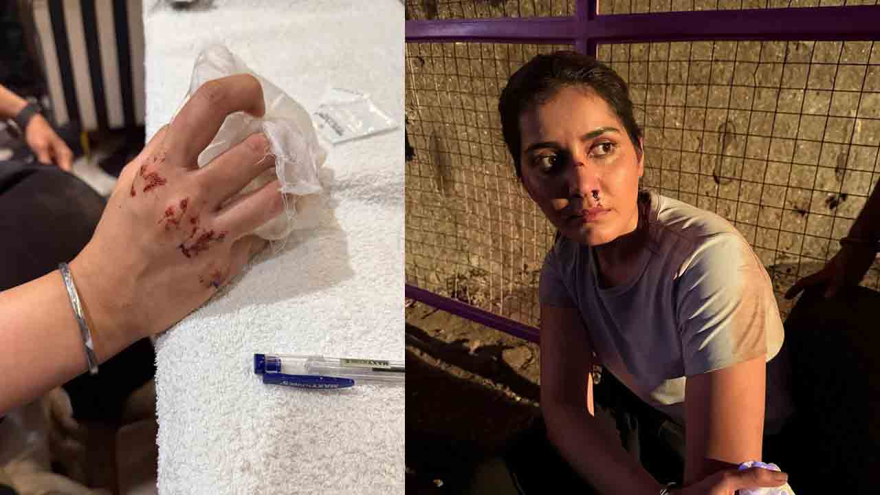 Raashii Khanna | షూటింగ్‌లో గాయపడ్డ రాశి ఖన్నా.. ఫొటోలు వైర‌ల్